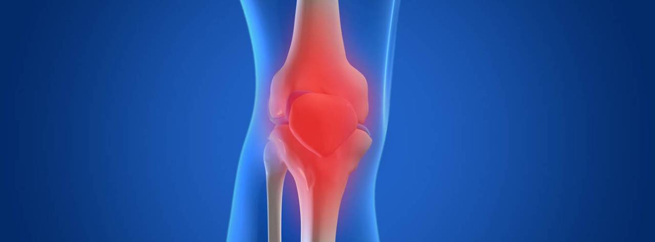 Osteoarthritis – A Curable Cause Of Pain